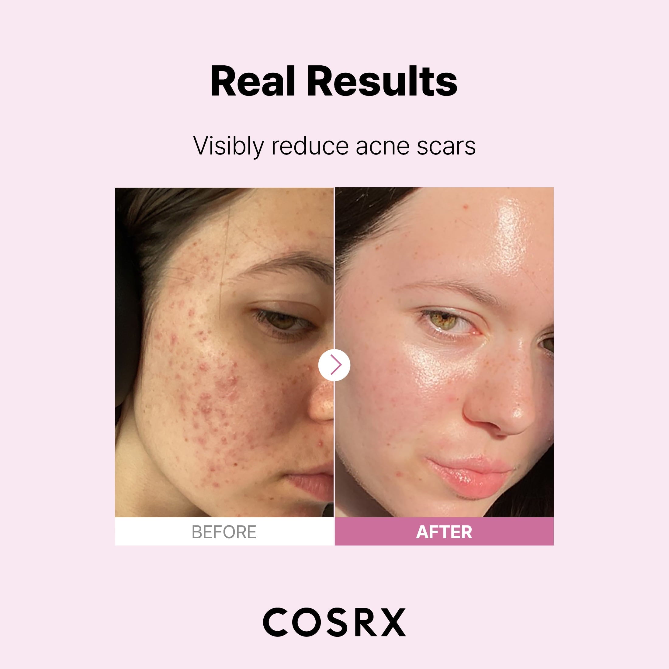 COSRX the Niacinamide 15 Serum (0.68 Fl.Oz)