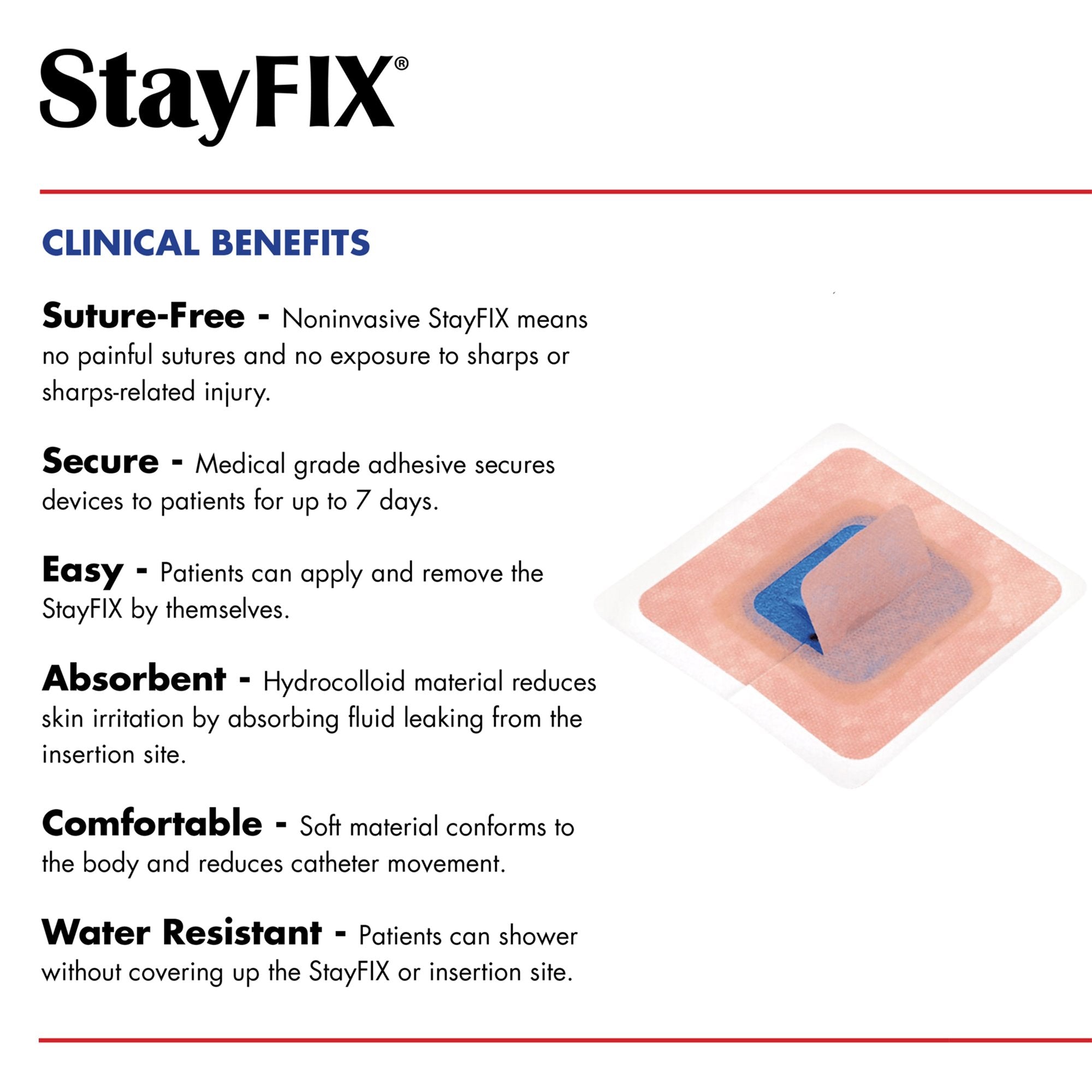 Stayfix® Catheter Fixation Device, Large (1 Unit)