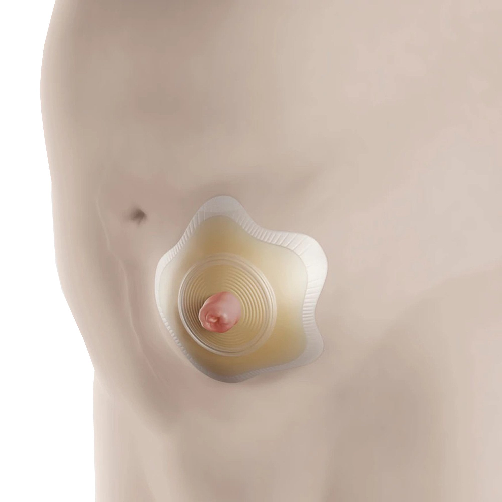 SenSura® Mio Convex Flip Ostomy Barrier with 35 mm Stoma Opening (5 Units)