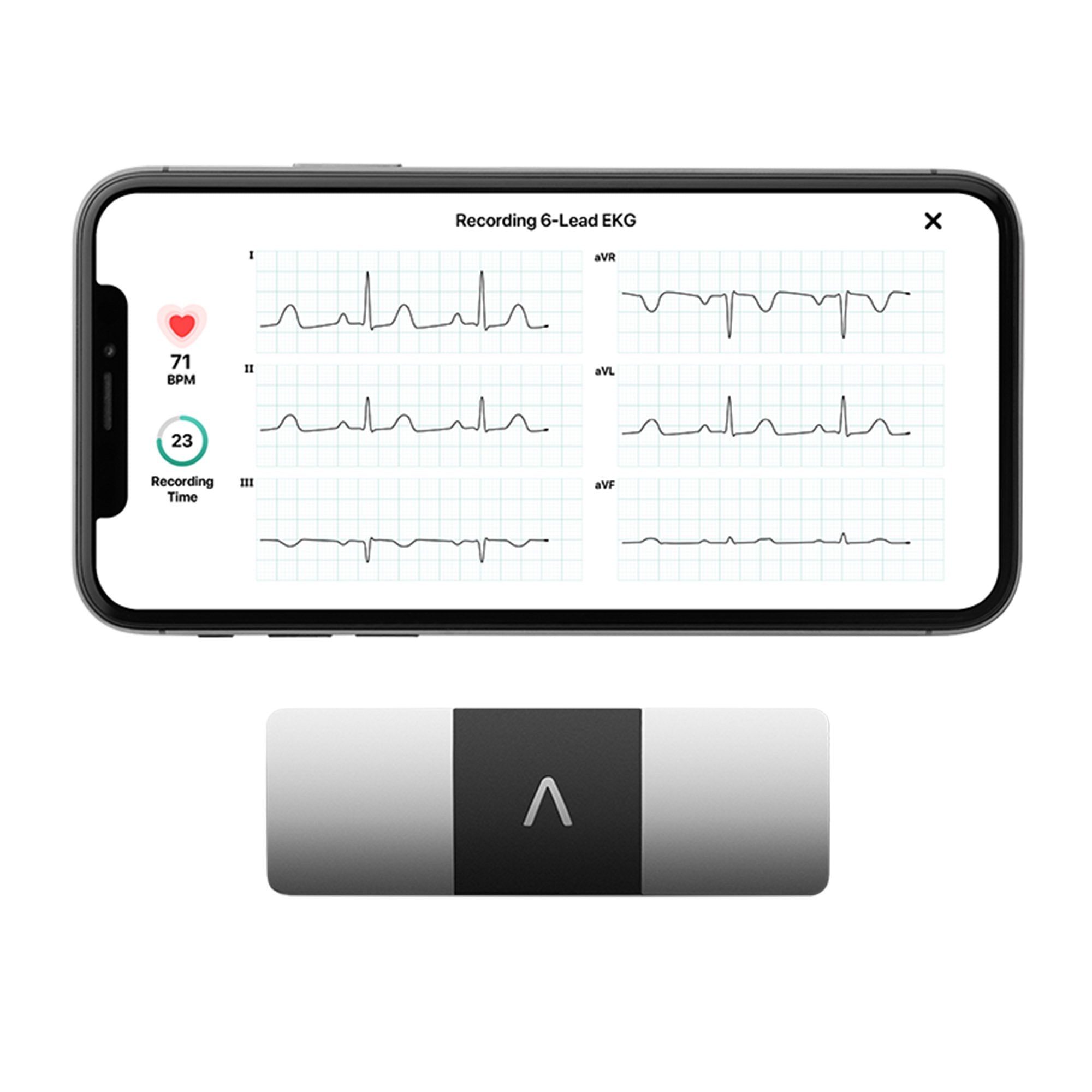 KardiaMobile® 6L Electrocardiograph (24 Units)