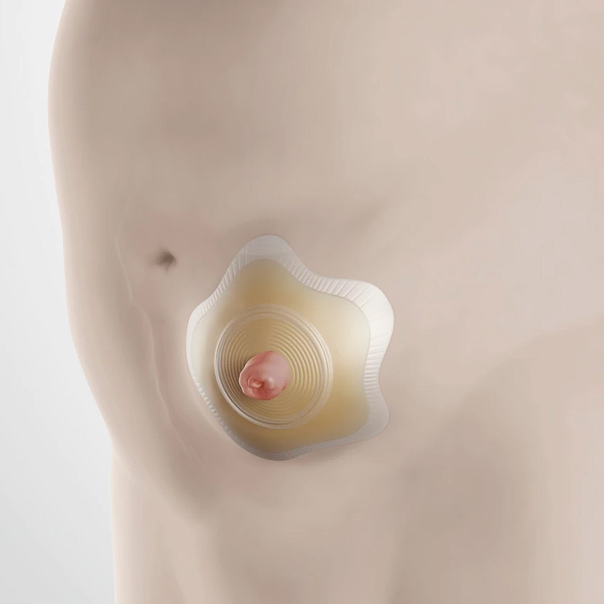 SenSura® Mio Convex Flip Ostomy Barrier (5 Units)