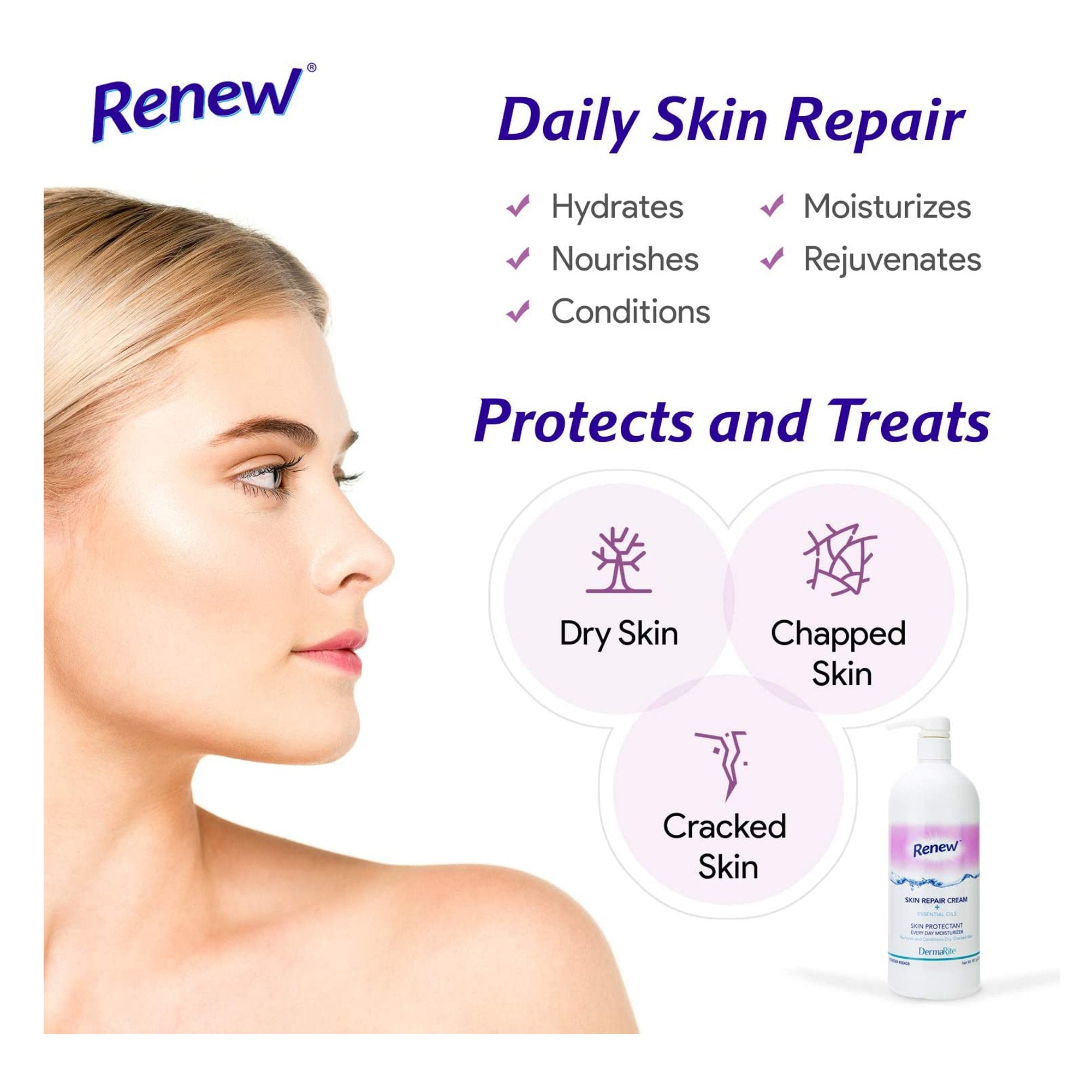 Renew™ Scented Skin Repair Cream, 4 oz. - Moisturizing Barrier (12-Pack)