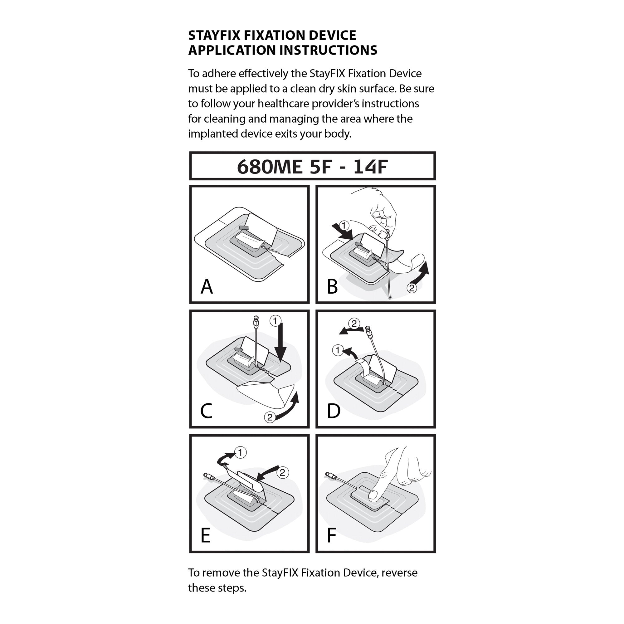 Stayfix® Catheter Fixation Device, Large (1 Unit)