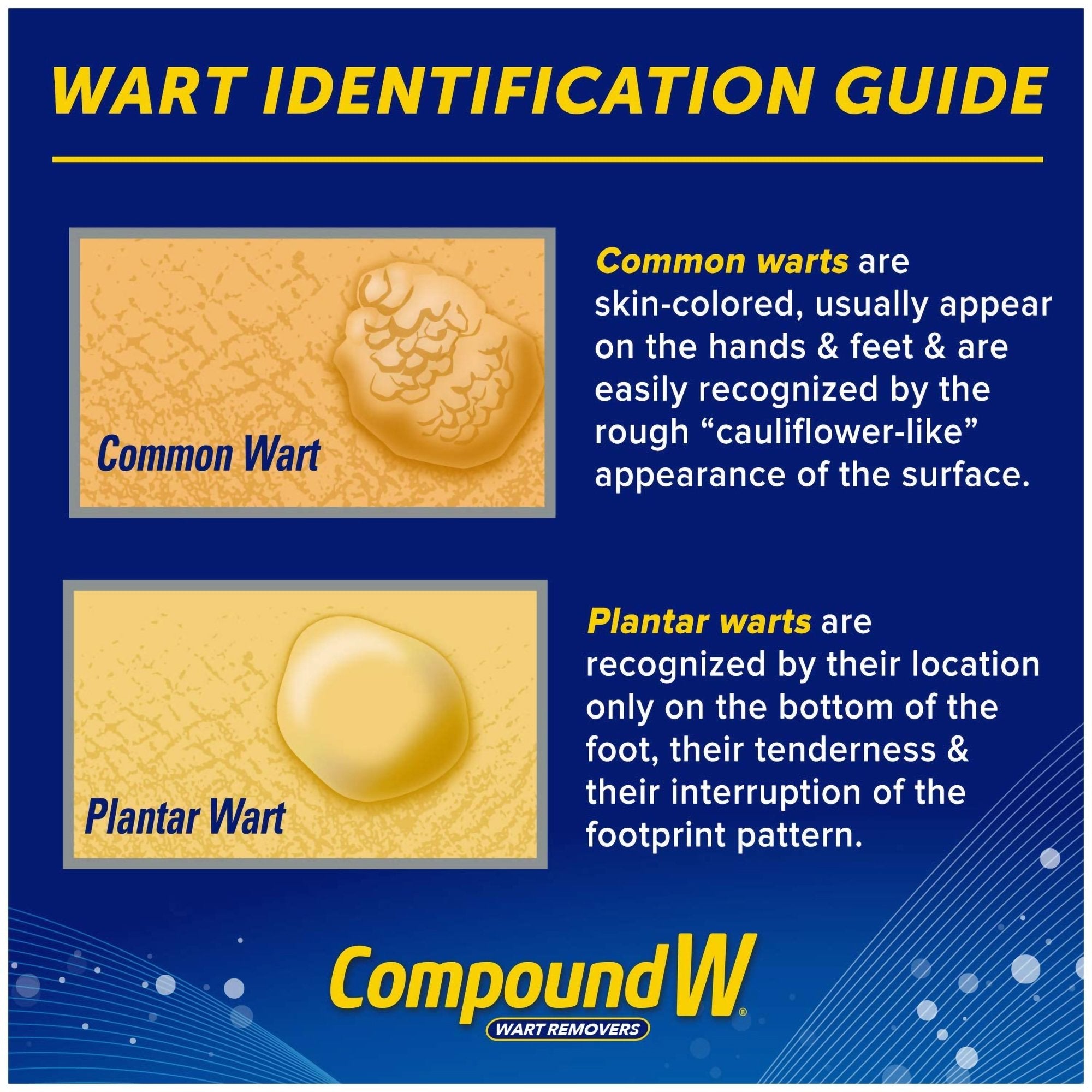 Compound W® Freeze Off® Dimethyl Ether / Propane Wart Remover (1 Unit)