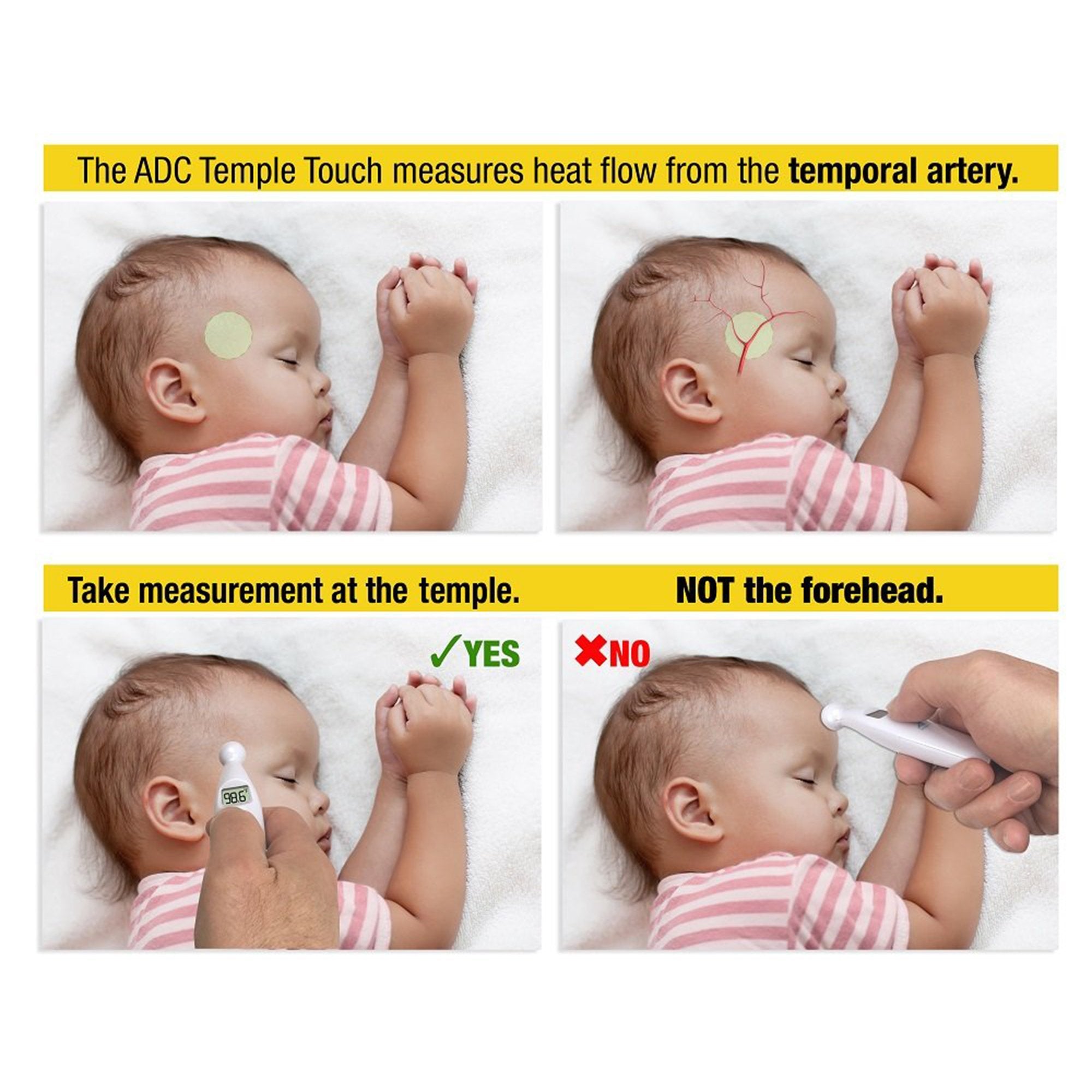 Temporal Contact Thermometer Adtemp™ 427 Temporal Probe Handheld (1 Unit)