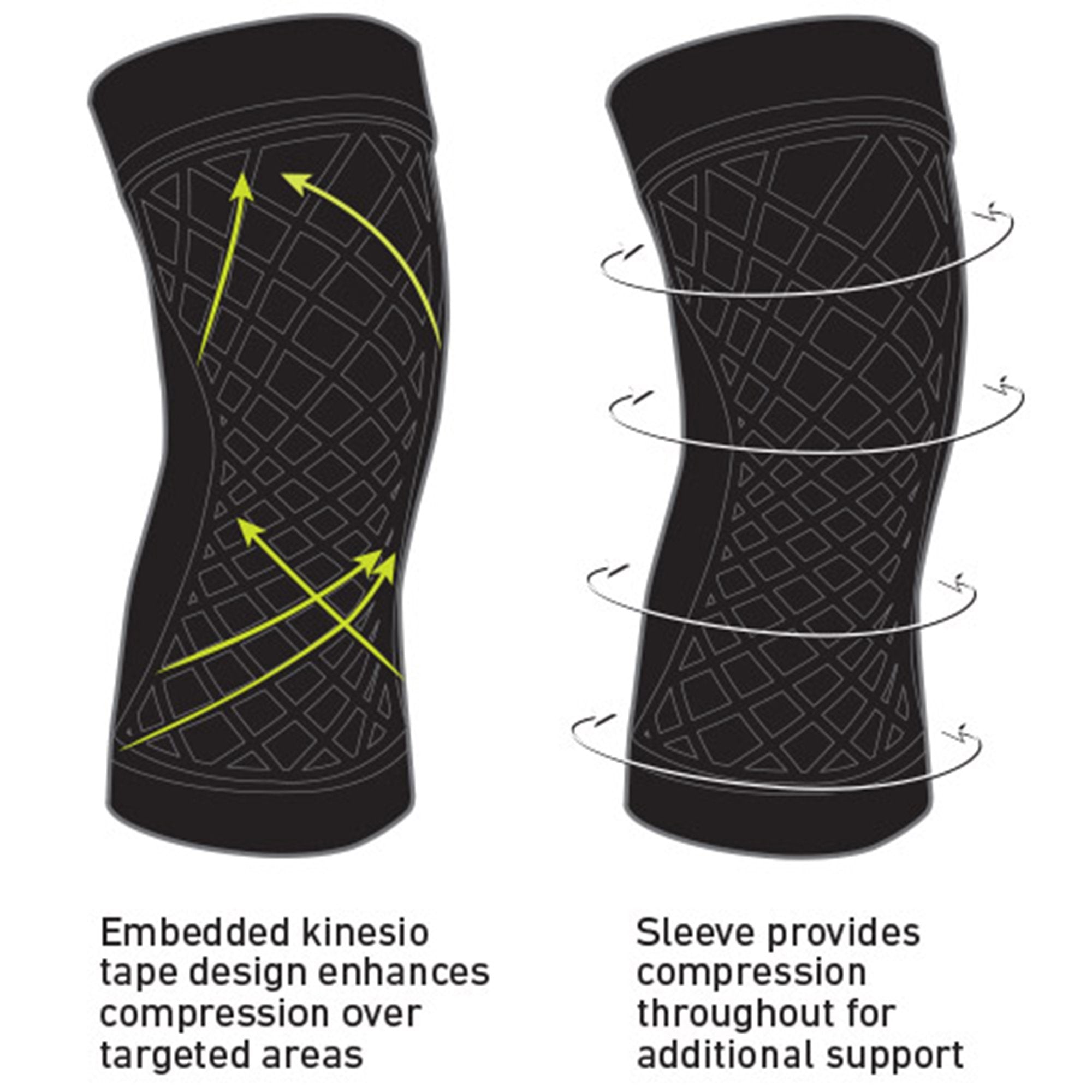 Spark Kinetic Knee Sleeve, Large (1 Unit)